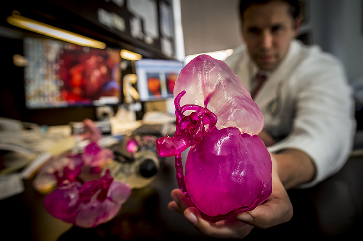 3D kidney model 3D kidney model