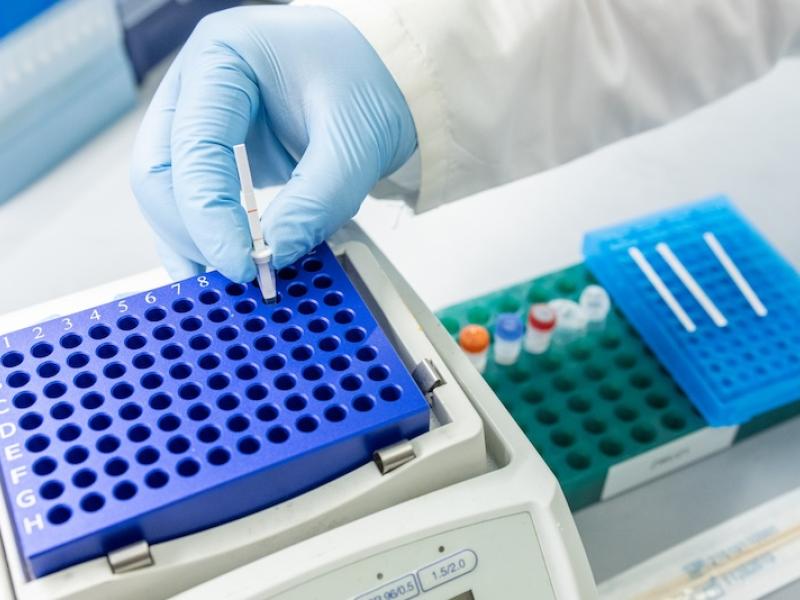 Tb test strip