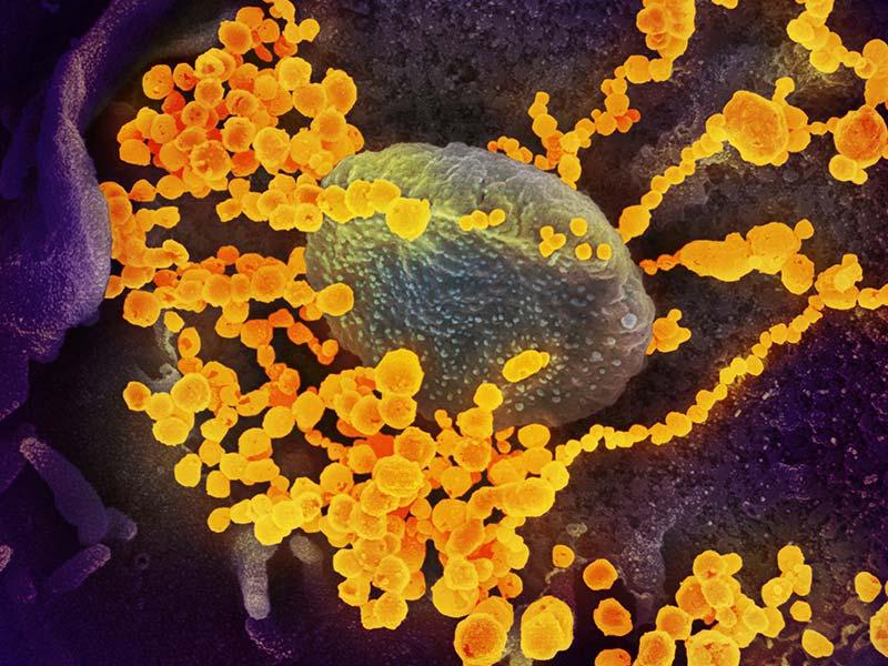 COVID-19 antibody COVID-19 antibody