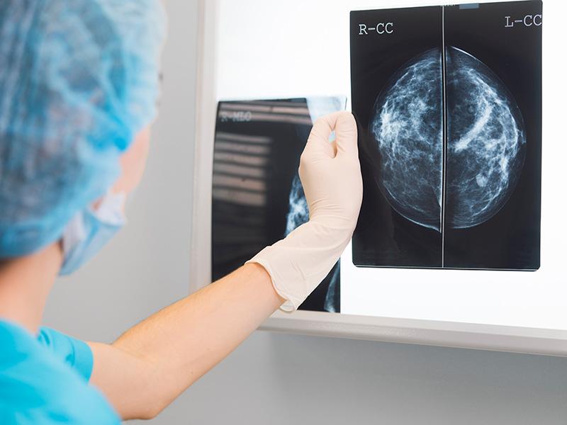 Doctor reviewing cancer scan Doctor reviewing cancer scan