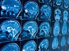 Brain Brain